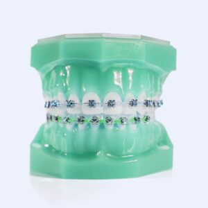 Dental braces